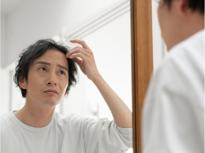前髪の後退が進んでAGA治療を検討している男性のイメージ